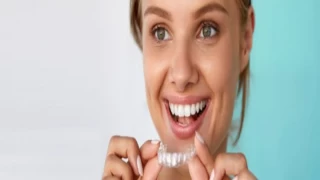 Invisalign, şeffaf plaklar kullanarak diş düzeltme tedavisi sağlayan yenilikçi bir yöntemdir.