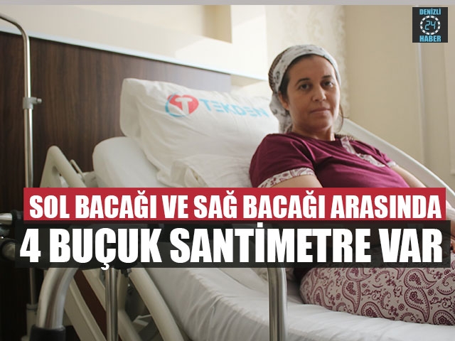Sol Bacağı Ve Sağ Bacağı Arasında 4 Buçuk Santimetre Var