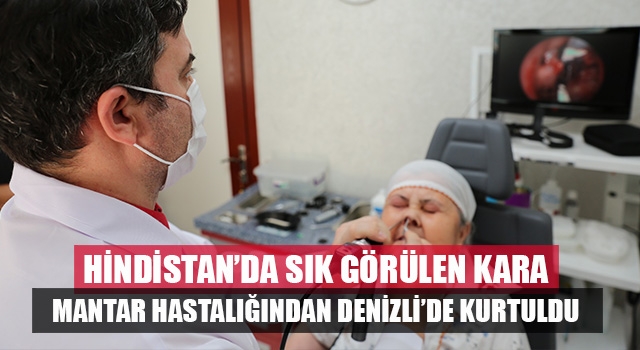 Hindistan’da daha sık görülen Kara Mantar Hastalığından başarılı operasyonla kurtuldu