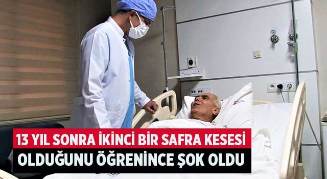 13 yıl sonra ikinci bir safra kesesi olduğunu öğrenince şok oldu