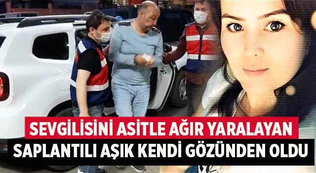Denizli’de asitli dehşet tüm vücudu yandı