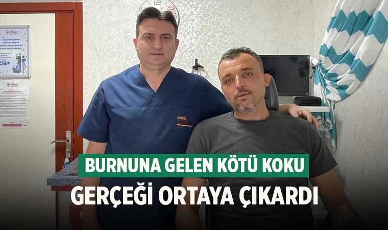 Burnuna Gelen Kötü Koku Gerçeği Ortaya Çıkardı