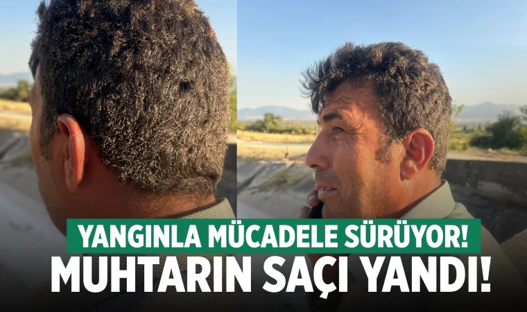 Denizli'de yangına müdahale eden muhtarın saçı yandı