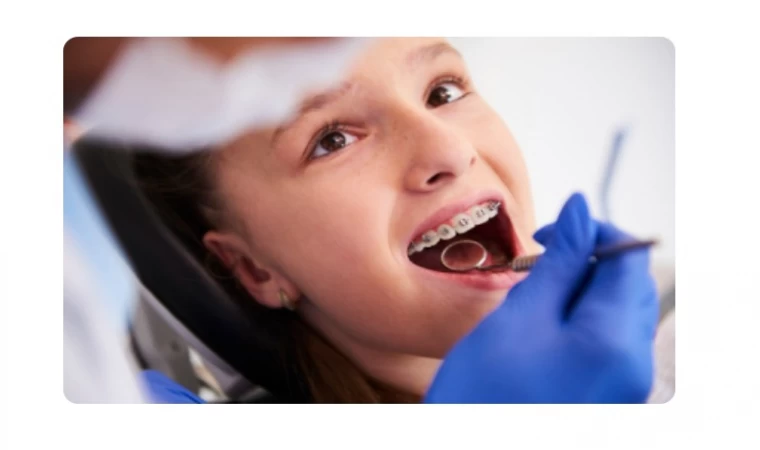 Ataşehir Ortodonti Tedavisi Seçenekleri Nasıl?