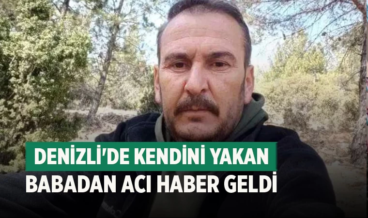 Denizli'de Kendini yakan babadan acı haber geldi