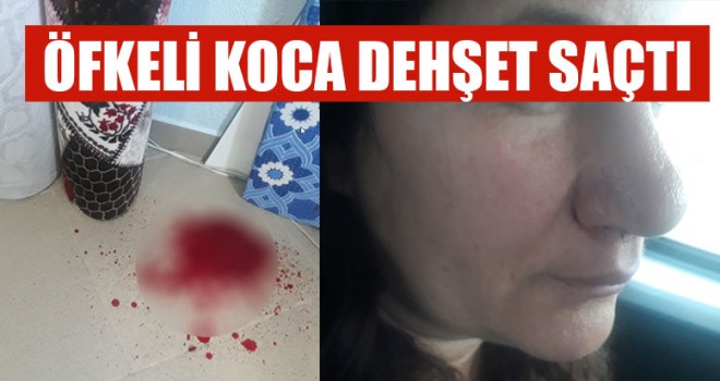 Öfkeli Koca Dehşet Saçtı