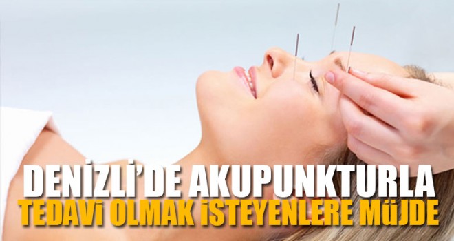 Denizli’de Akupunkturla Tedavi Olmak İsteyenlere Müjde