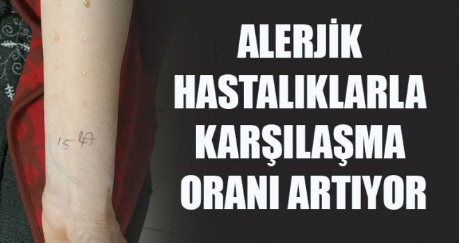 Alerjik Deri Testi Nasıl Uygulanır?