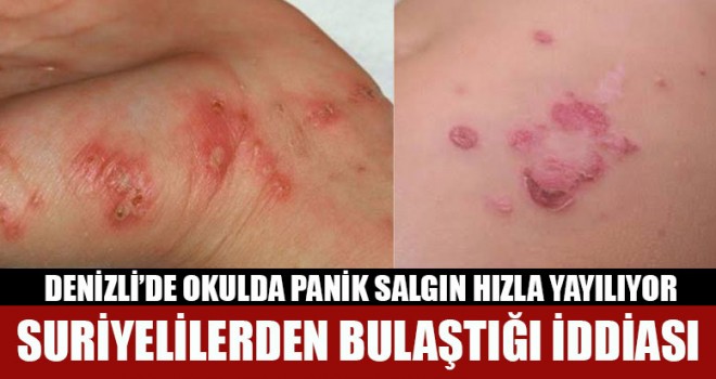 Denizli’de Okulda Panik Salgın Hızla Yayılıyor